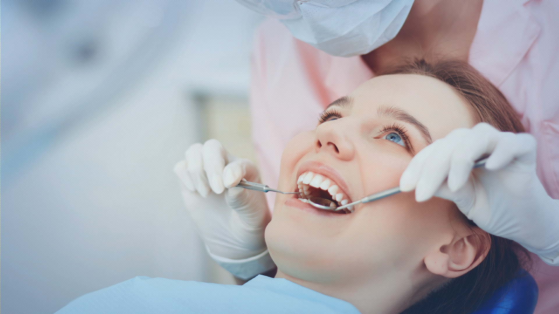 Implantes Dentários